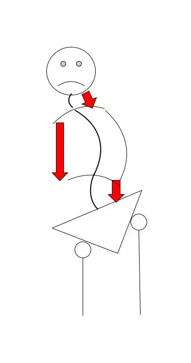 Postural distortion can cause an "S" curve in the spine.